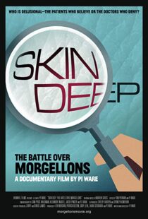 دانلود مستند Skin Deep: The Battle Over Morgellons 2019104233-842713